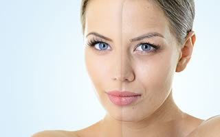 Skin Rejuvenation Rainham Medway Kent