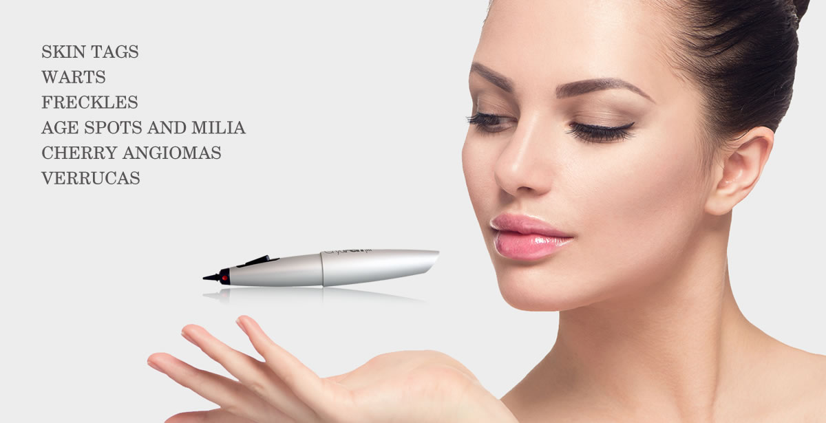 Cryopen Treatment Rainham Medway Kent Cryopen Treatment Rainham Medway Kent