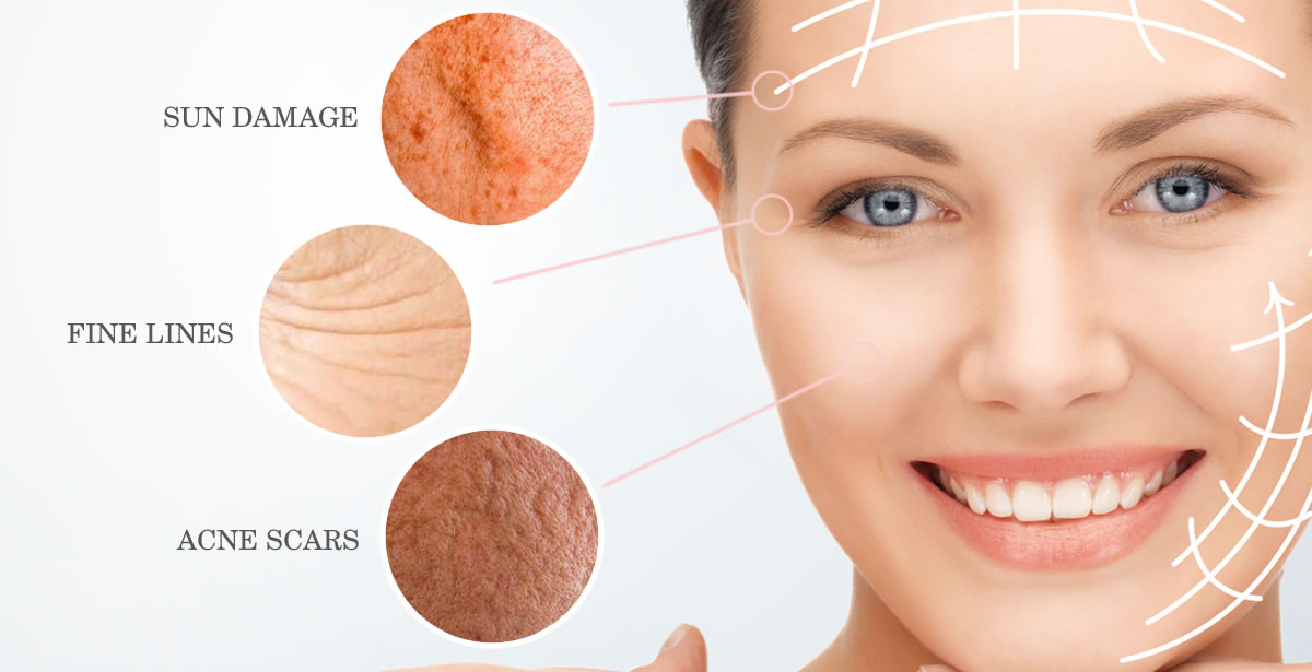 Skin Rejuvenation Rainham Medway Kent Skin Rejuvenation Rainham Medway Kent