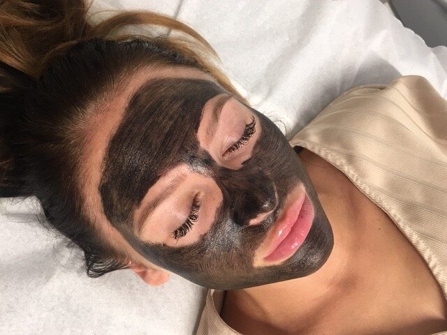 The “Famous Carbon Facial” – Worth the Hype?