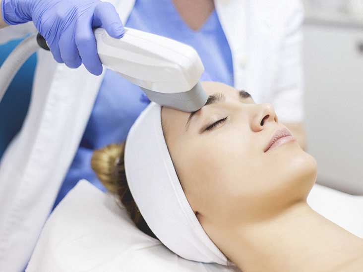 IPL Laser Treatment Medway Kent IPL Laser Treatment Medway Kent
